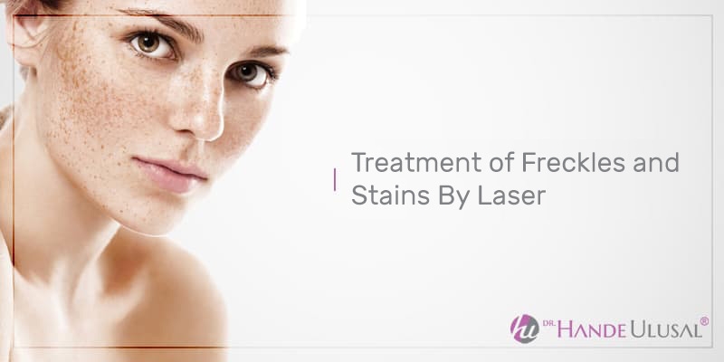 Treatment Of Freckles And Stains By Laser Dr Hande Ulusal 9647